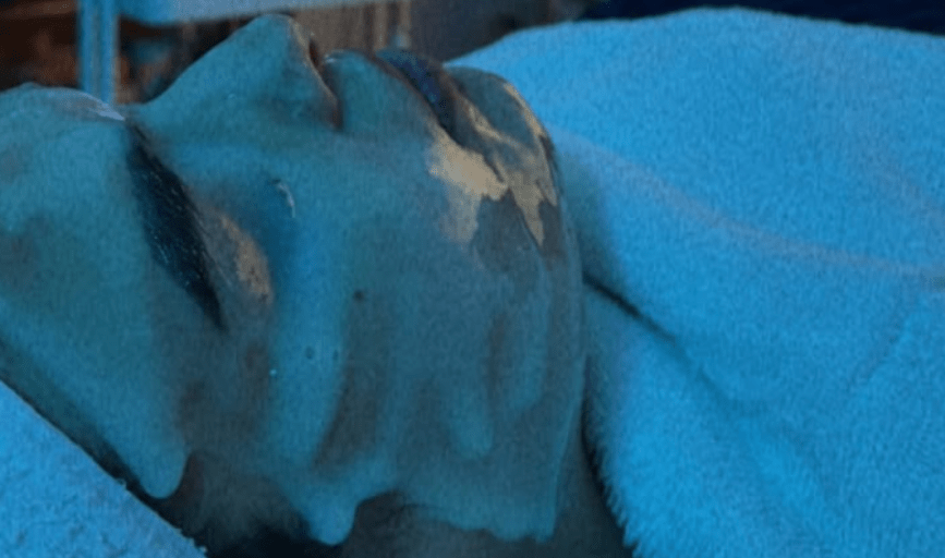 FACIAL TREATMENTS